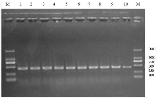 Codon-optimized insulin degludec precursor gene and expression method thereof