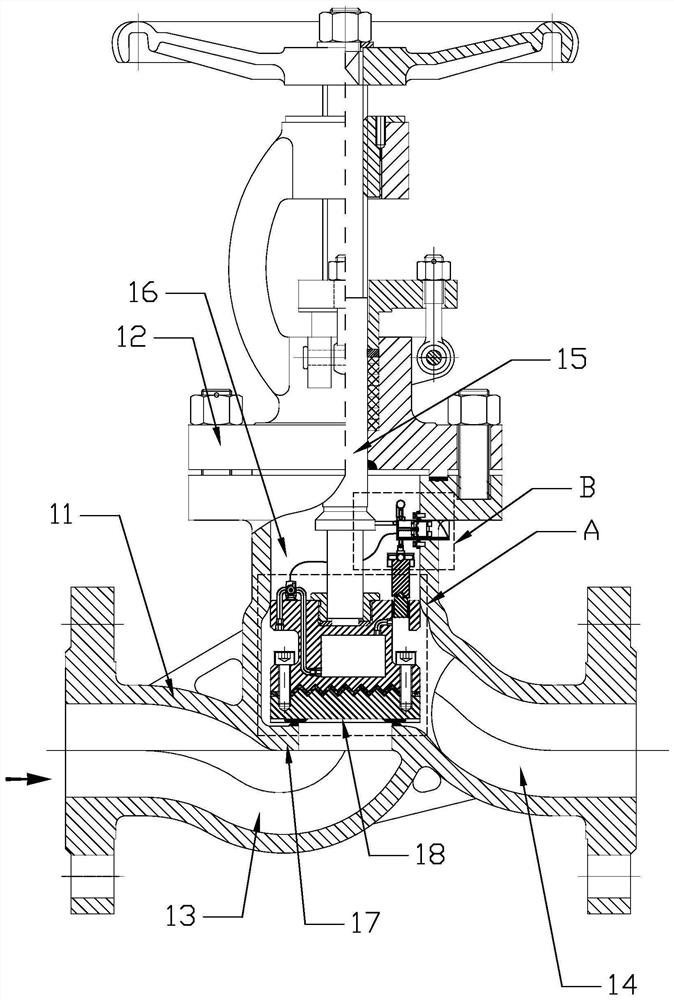 A globe valve that can enhance the sealing performance between the valve core and the valve seat