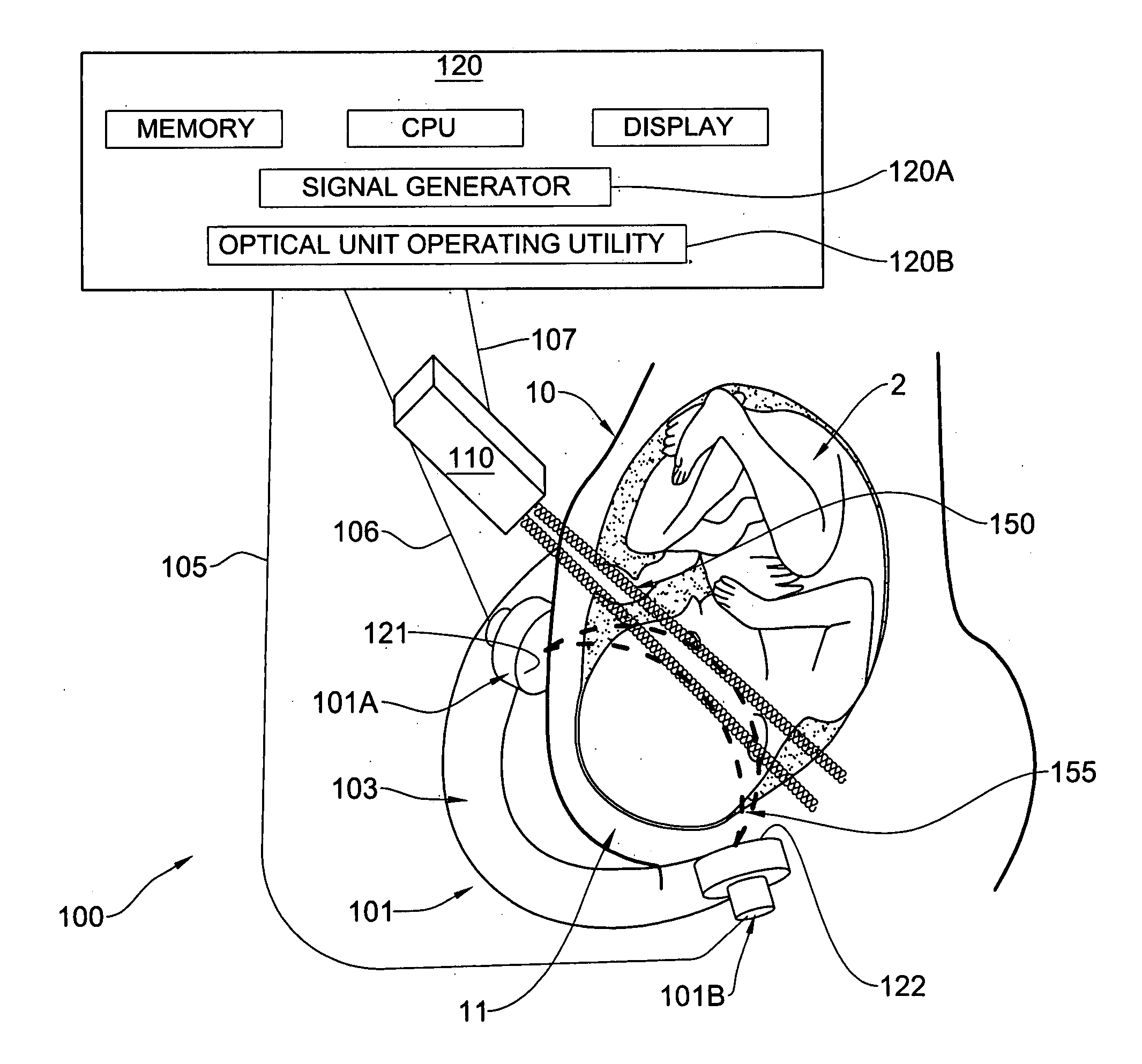 Method and apparatus for noninvasively monitoring parameters of a region of interest in a human body