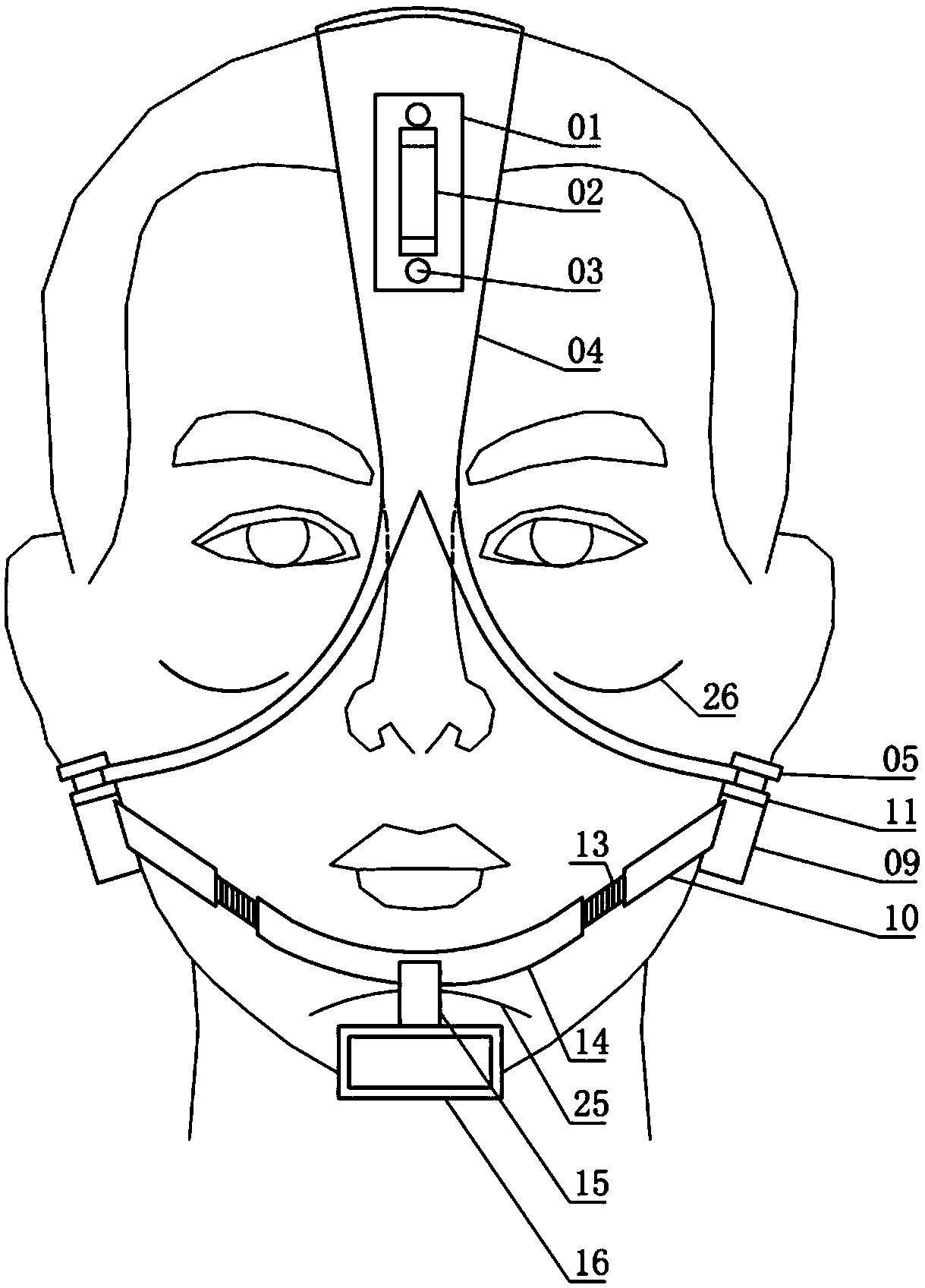 Zygomatic chin expansion angle type opening device