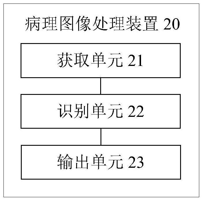 Pathological image processing method and device, storage medium and processor