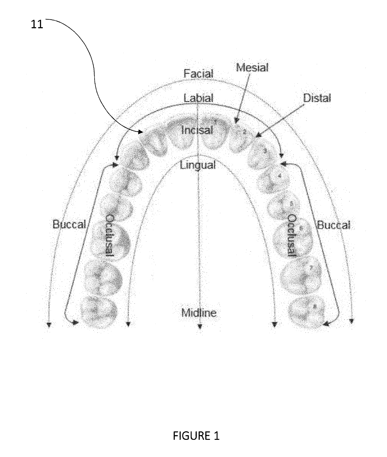 Teeth Aligner System
