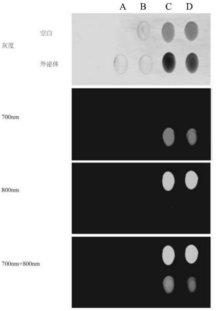 A kind of exosome with diagnosis and treatment function and preparation method thereof