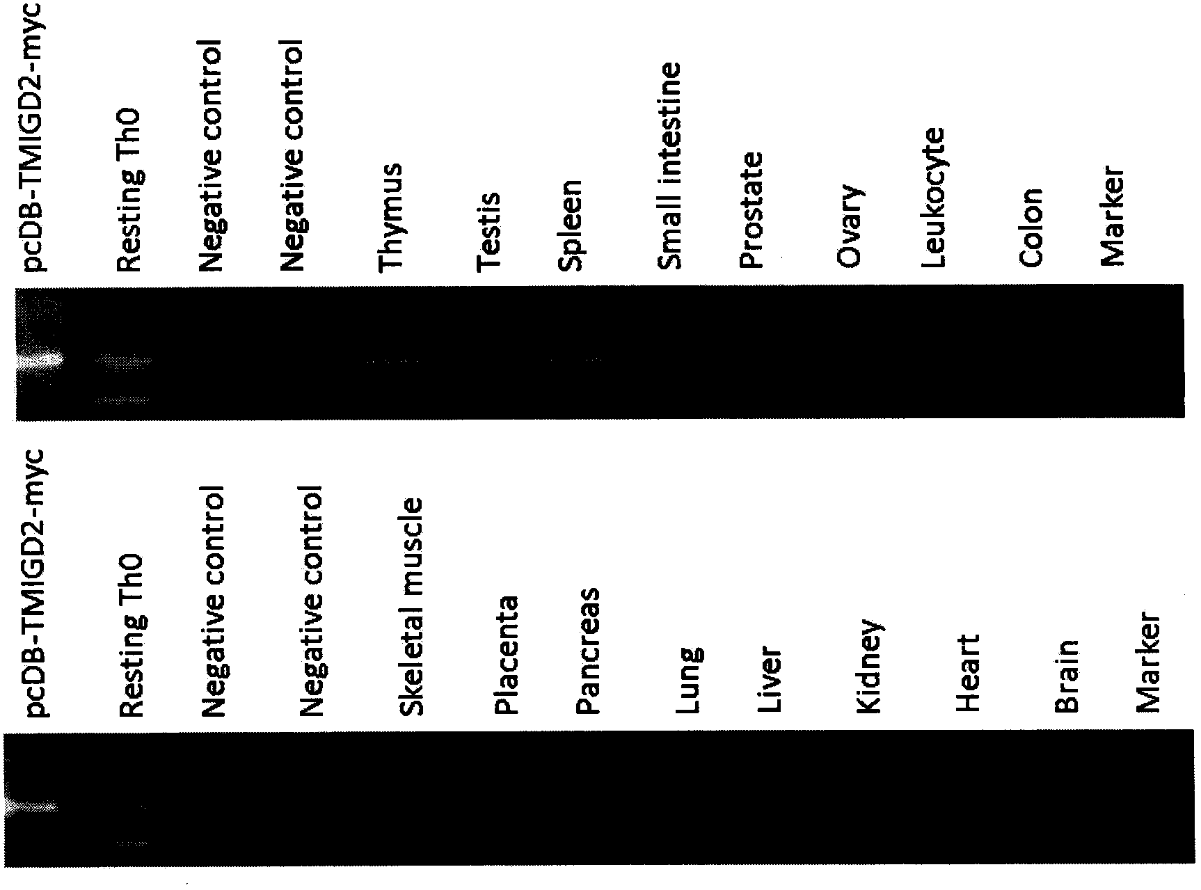 Applications of novel human latent leukocyte differentiation antigen TMIGD2 discovered by utilization of immunomic technology