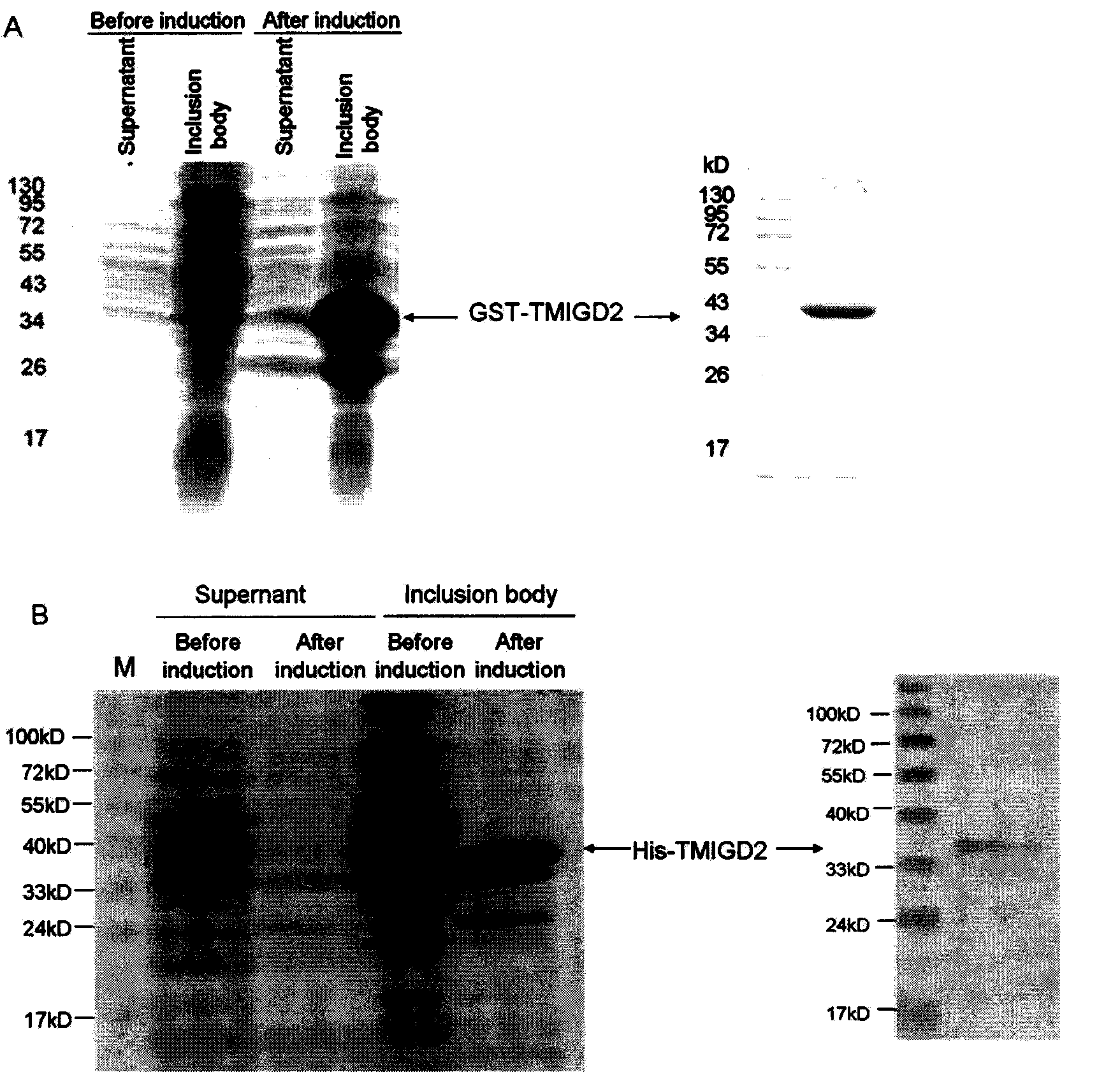 Applications of novel human latent leukocyte differentiation antigen TMIGD2 discovered by utilization of immunomic technology