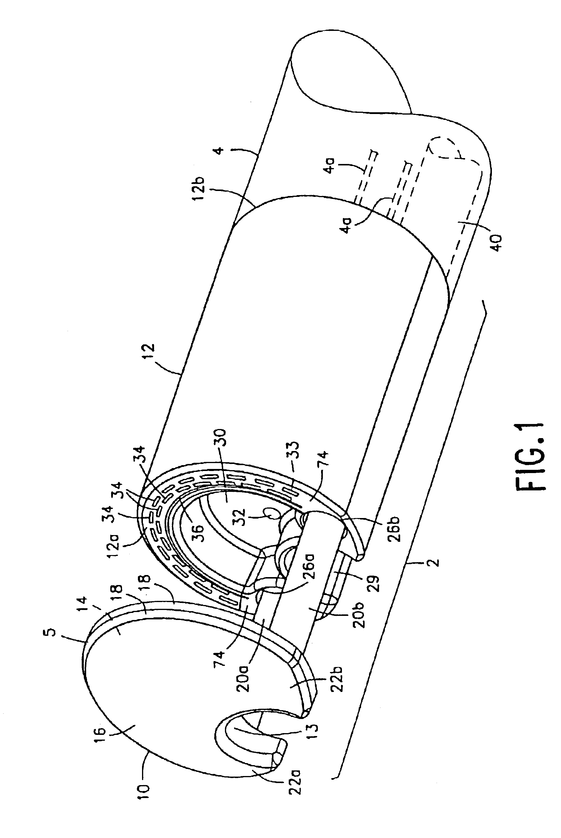 Integrated surgical staple retainer for a full thickness resectioning device