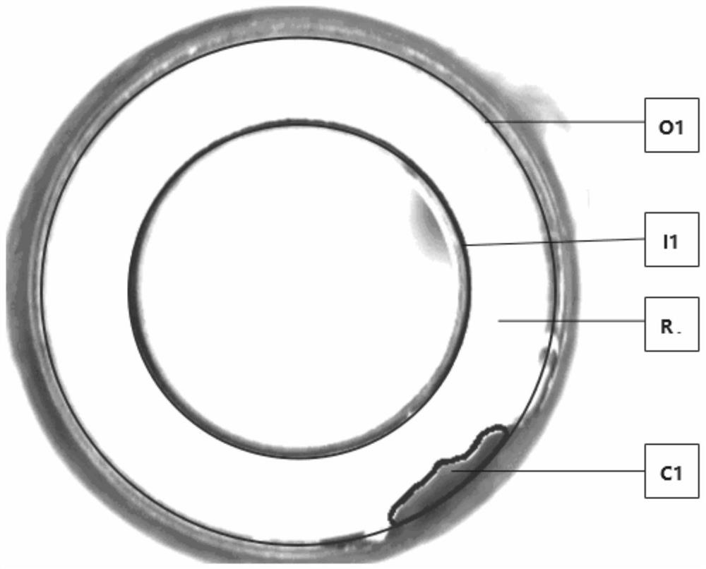 Detection device and method for breakage of infusion bottle opening