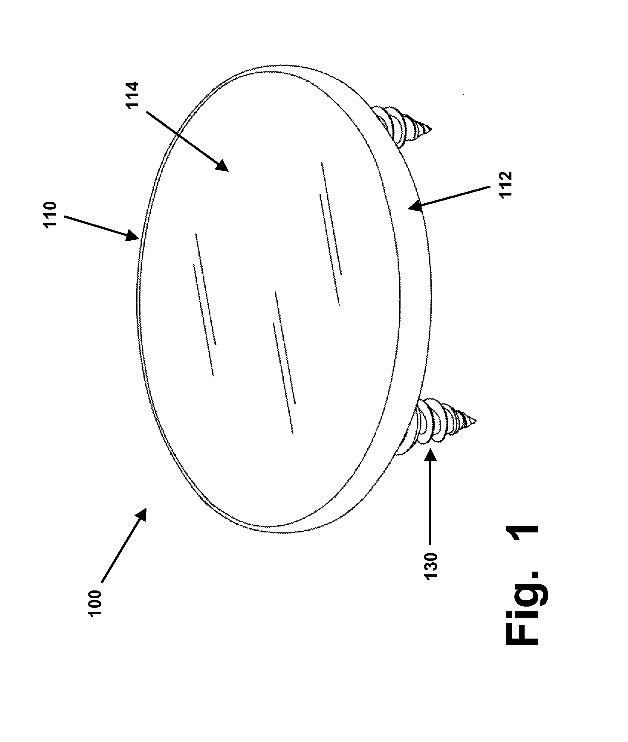 Rim Anchoring Systems for Flexible Surgical Implants for Replacing Cartilage