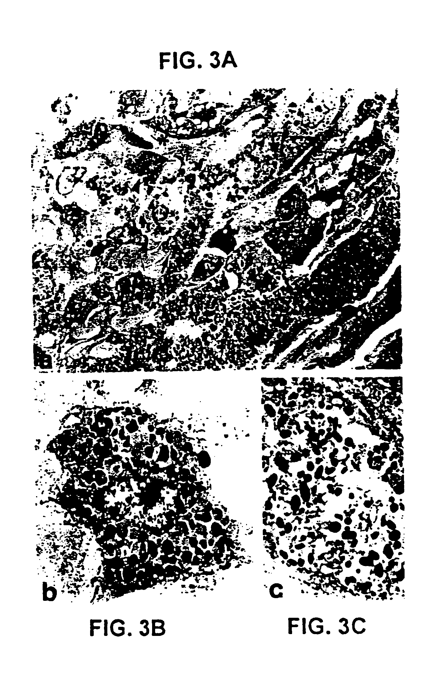Methods for inhibiting cutaneous inflammation and hyperpigmentation