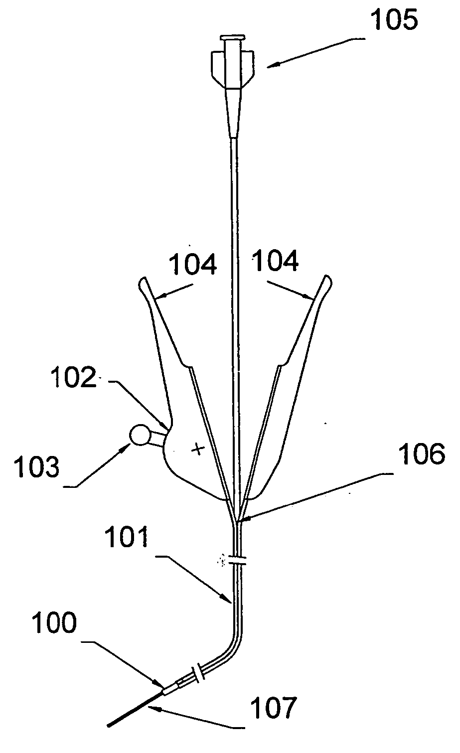 Methods of using a telescoping guide catheter with peel-away outer sheath