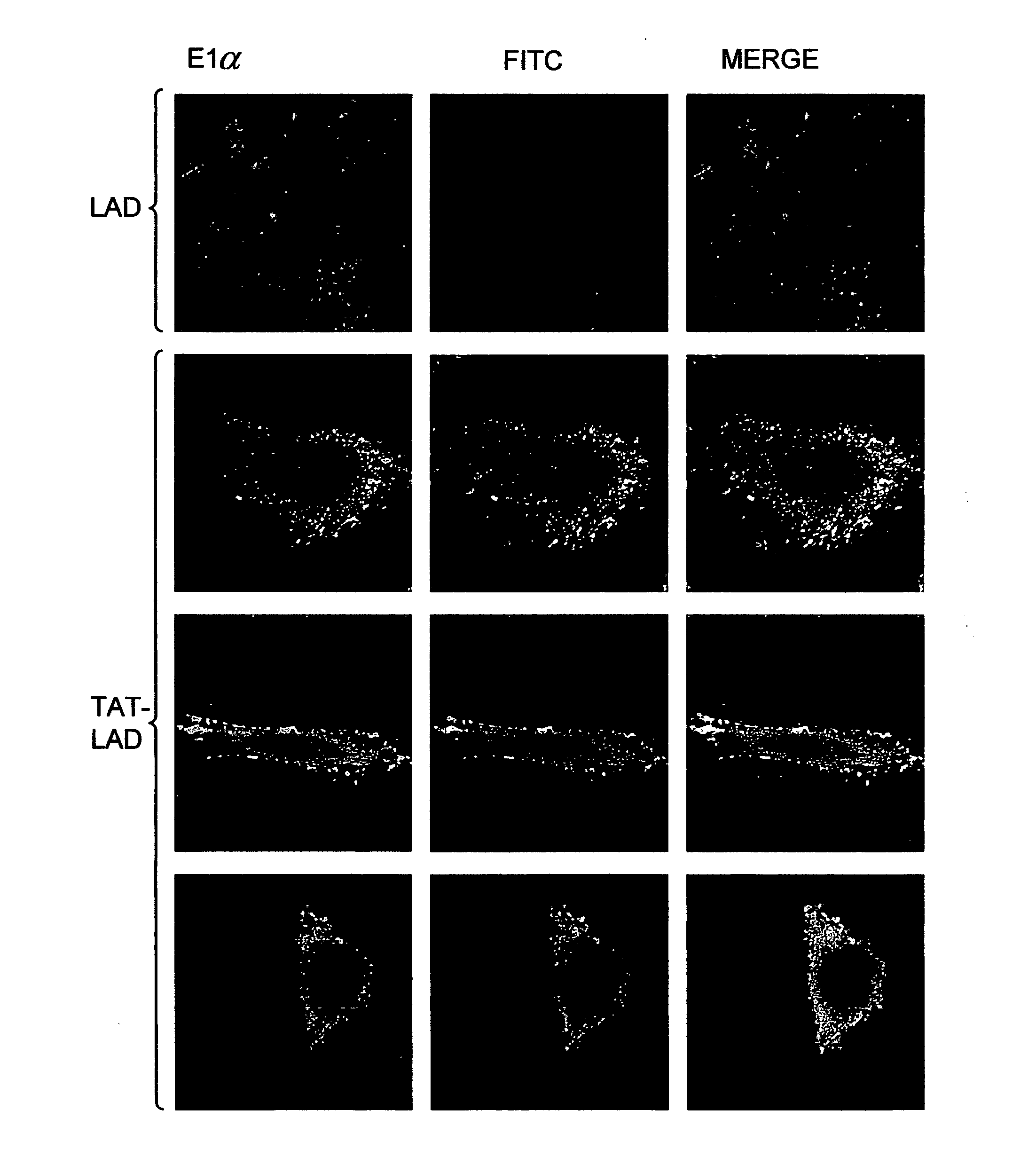 Methods and compositions for treatment of mitochondrial disorders