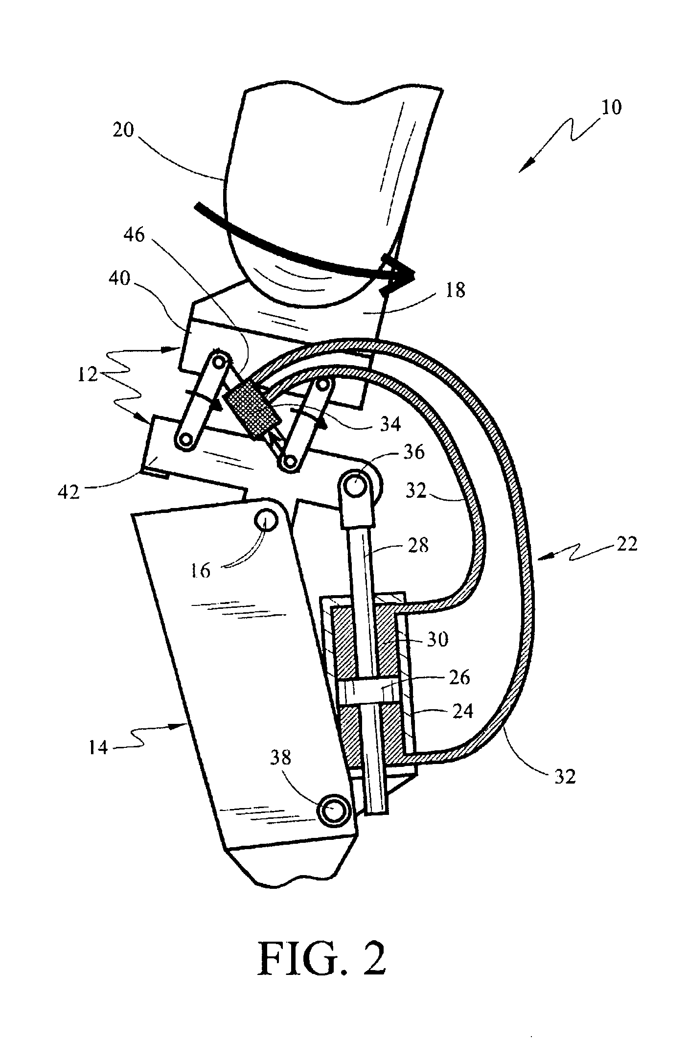 Above-knee prosthesis with variable resistance knee joint