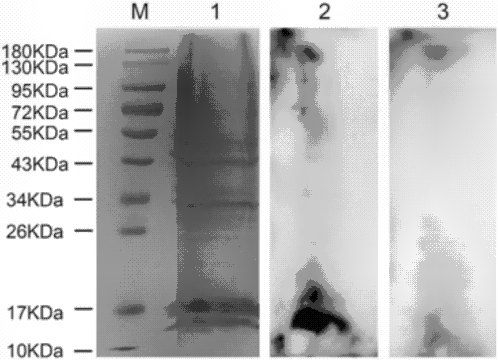 Receptor protein capable of specifically binding to Mycoplasma genitalium MgPa, separation method and uses thereof