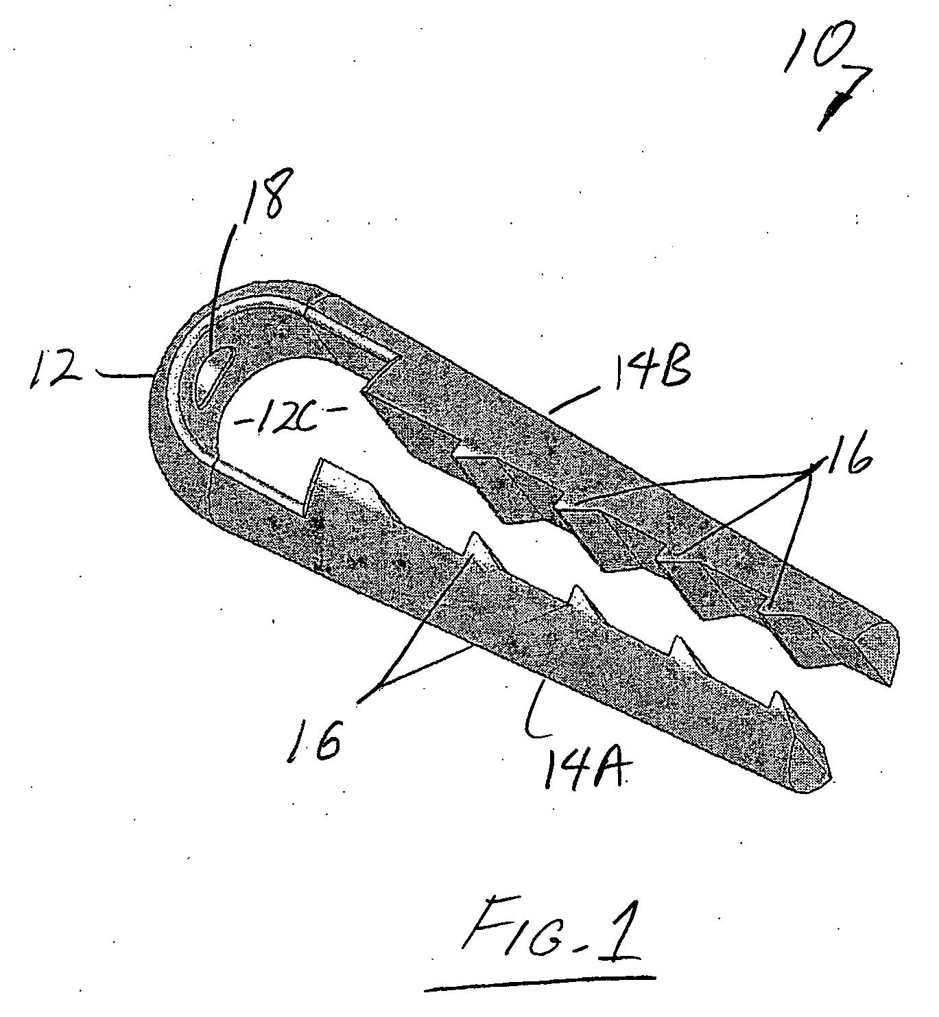 Tapered anchor for tendon graft