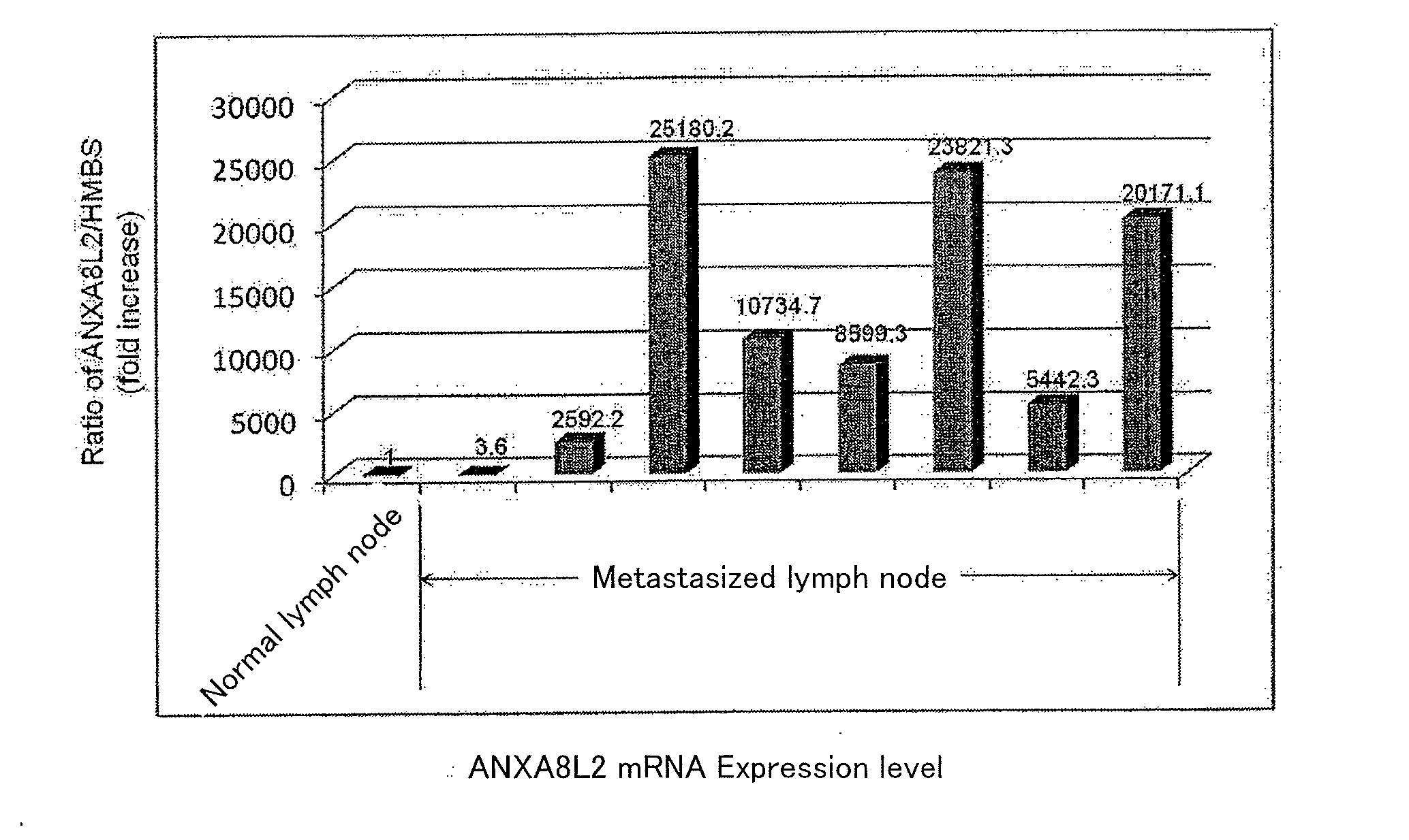 Method for analyzing cervical lymph node metastasis, and tumor marker for head and neck cancer