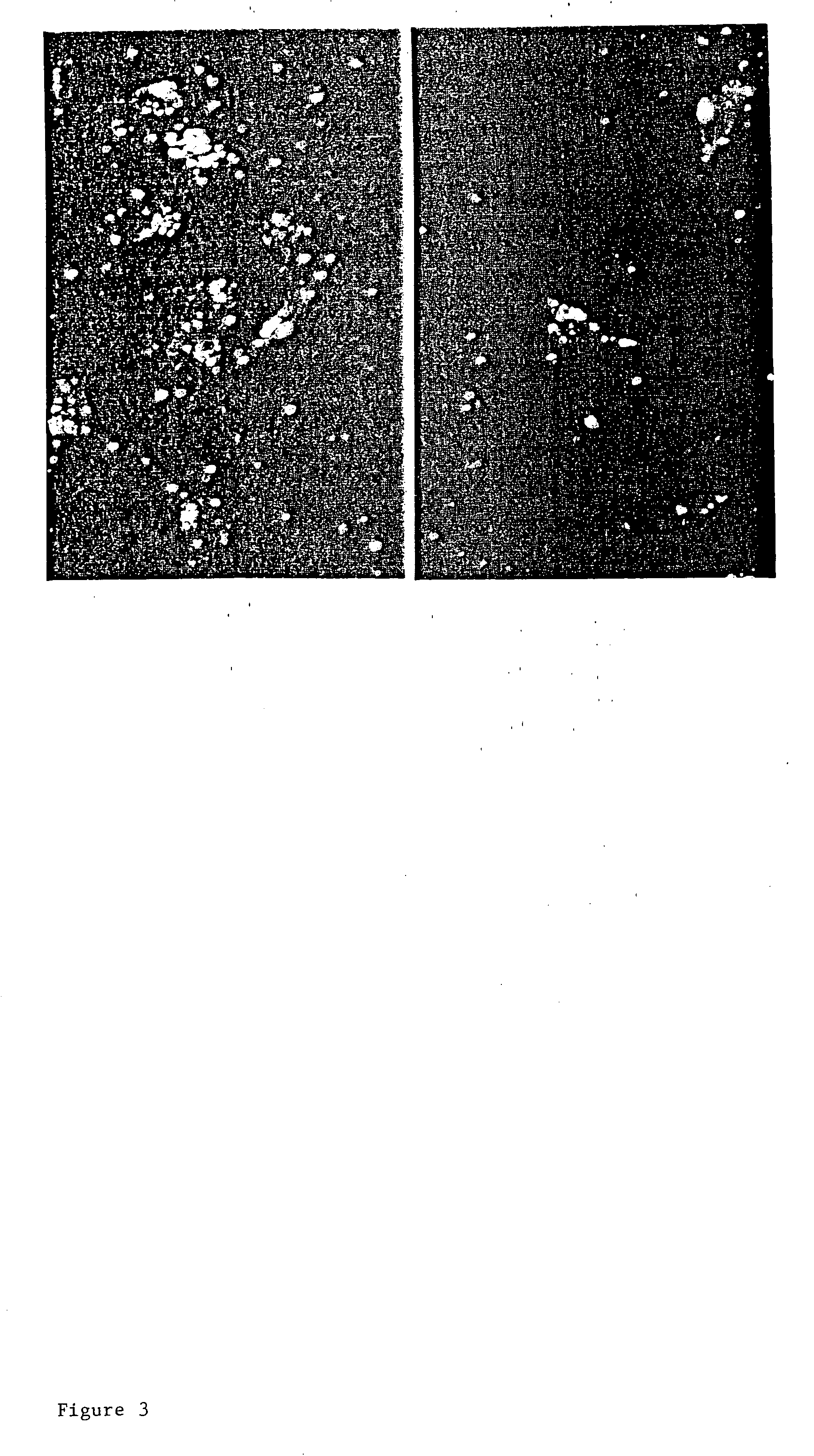 Diagnostic test for neuropsychiatric systemic lupus erythematosus