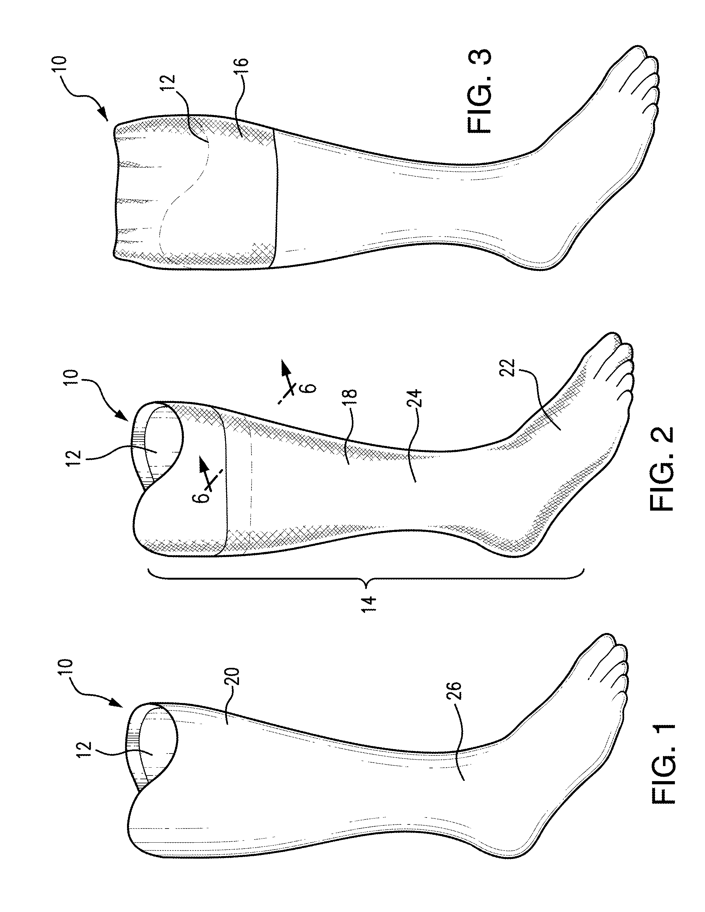 Skin-Like Prosthesis Cover Having Substantially Permanently Attached and Releasably Attached Portions