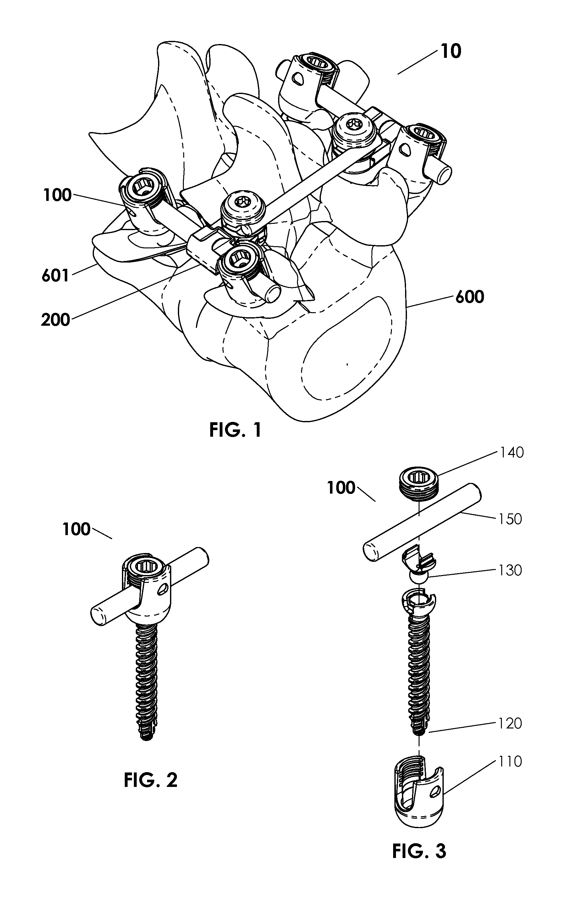 Spinal stabilization system