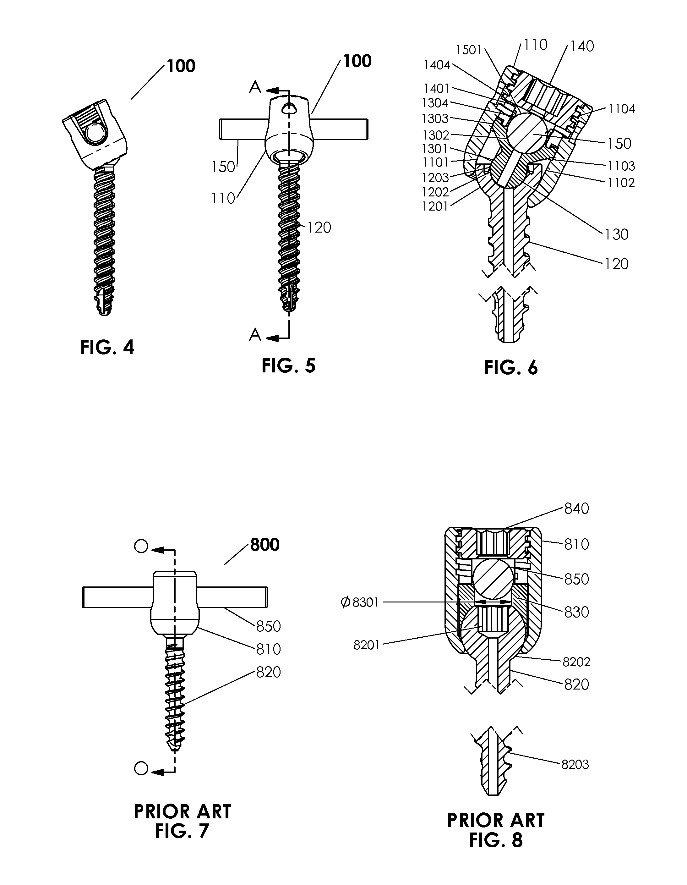 Spinal stabilization system