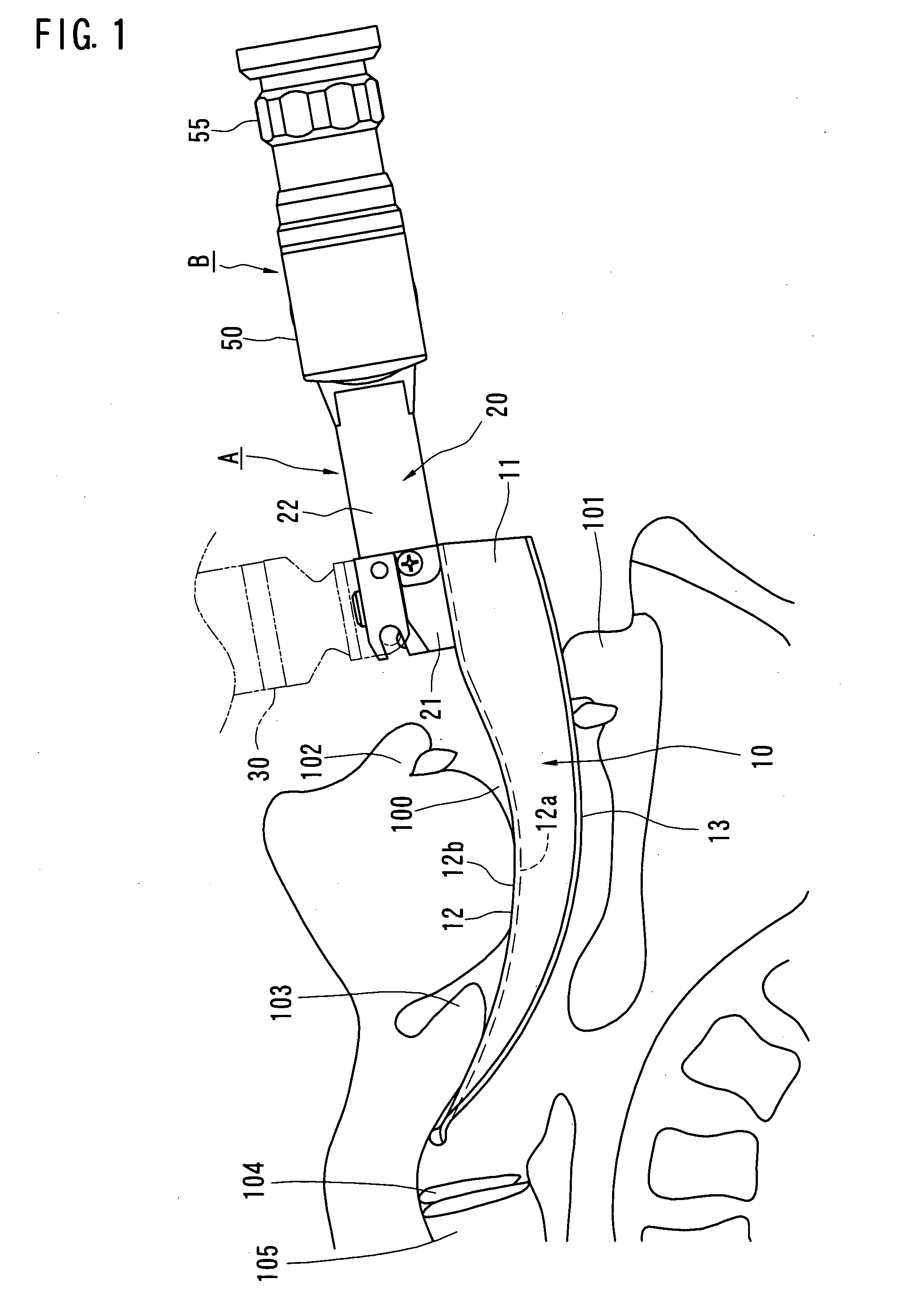 Airway tube guiding apparatus