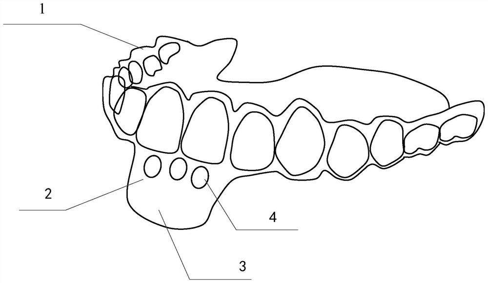 Oral appliance