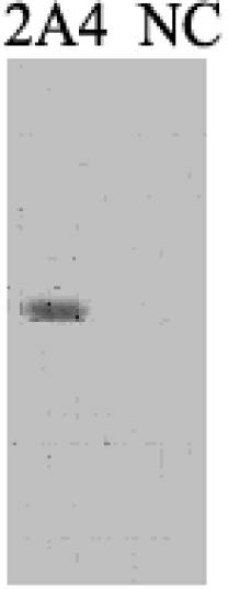 Brucella bp26 protein epitope, monoclonal antibody and application thereof