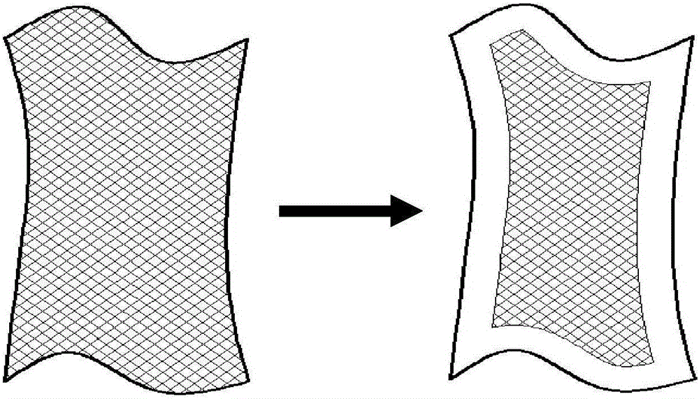 Manufacturing method of personalized retaining splint for department of orthopedics