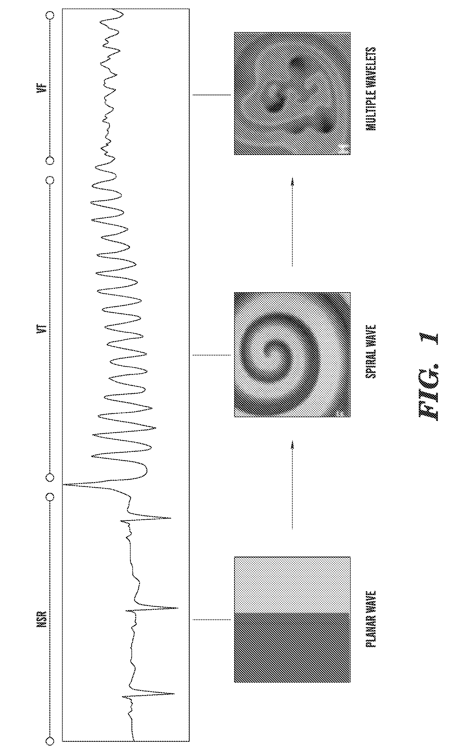 Method of identifying strategies for treatment or prevention of ventricular fibrilation and ventricular tachycardia