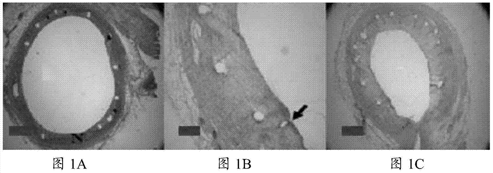 Medicine for preventing and curing restenosis, and preparation method and using method thereof