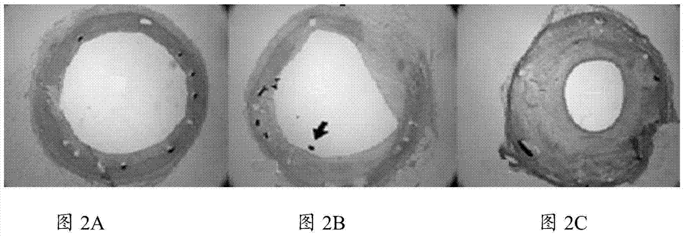 Medicine for preventing and curing restenosis, and preparation method and using method thereof