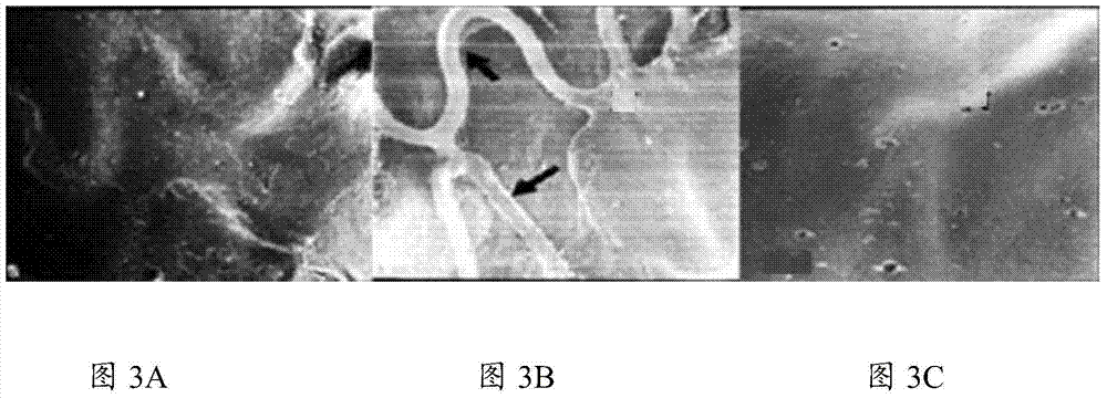 Medicine for preventing and curing restenosis, and preparation method and using method thereof