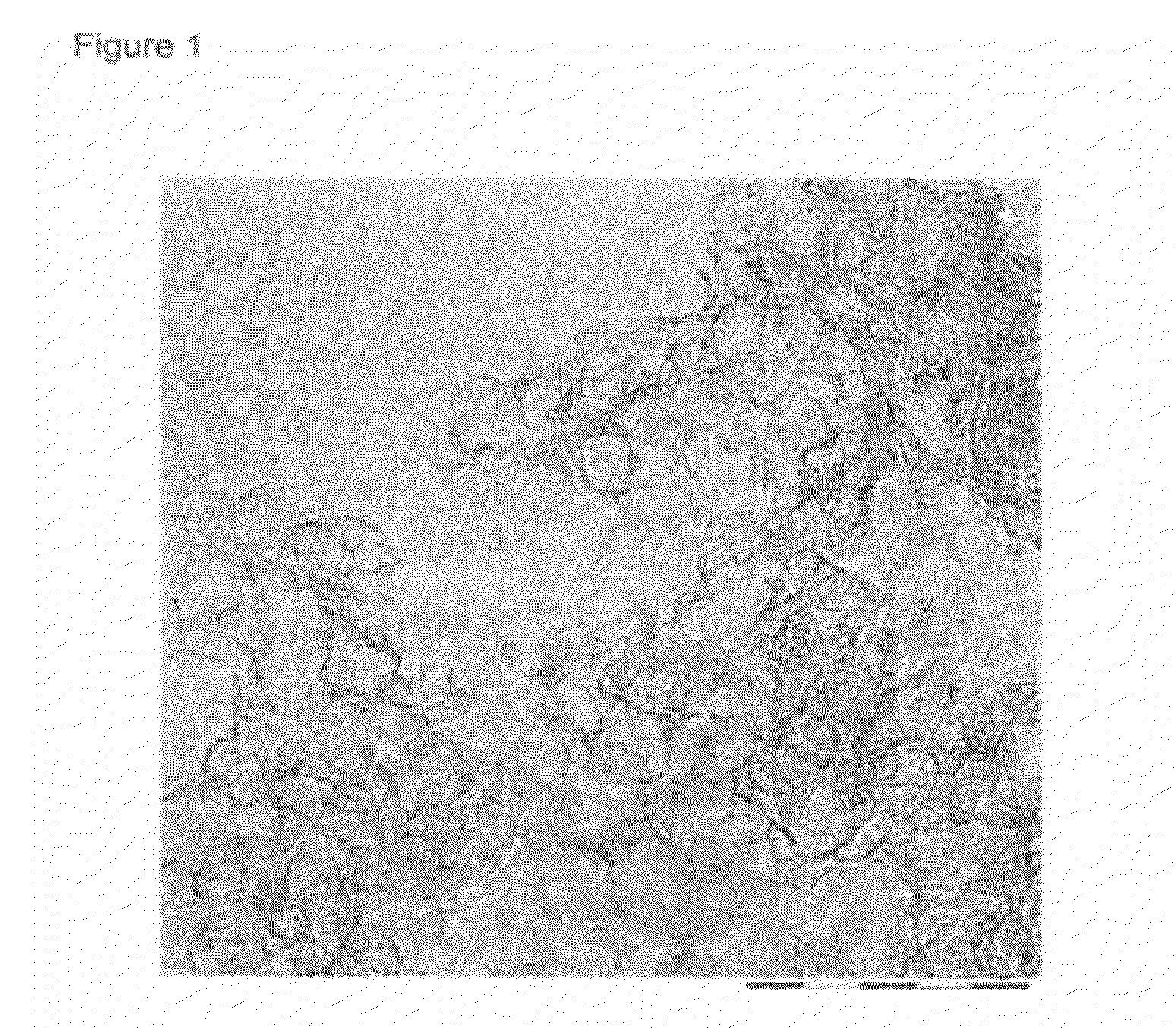 Particulate porous carbon material and use thereof in lithium cells