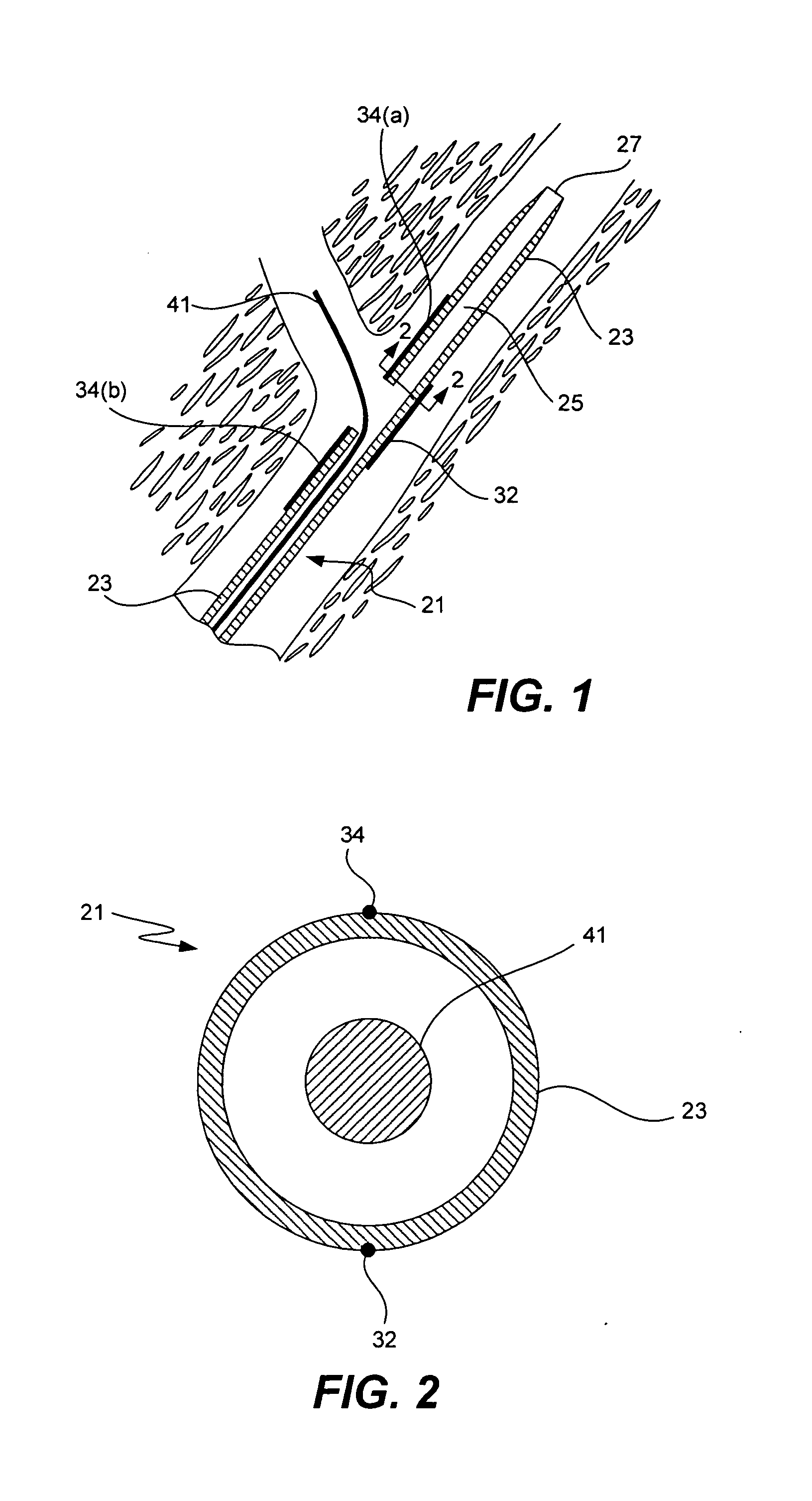 Catheter having markers to indicate rotational orientation