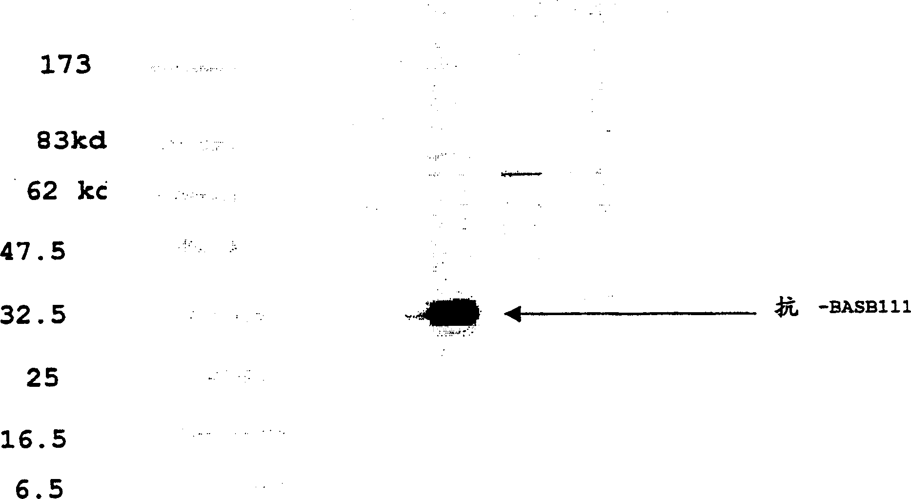 BASB 111 polypeptide and polynucleotide from moraxella cathraahalis