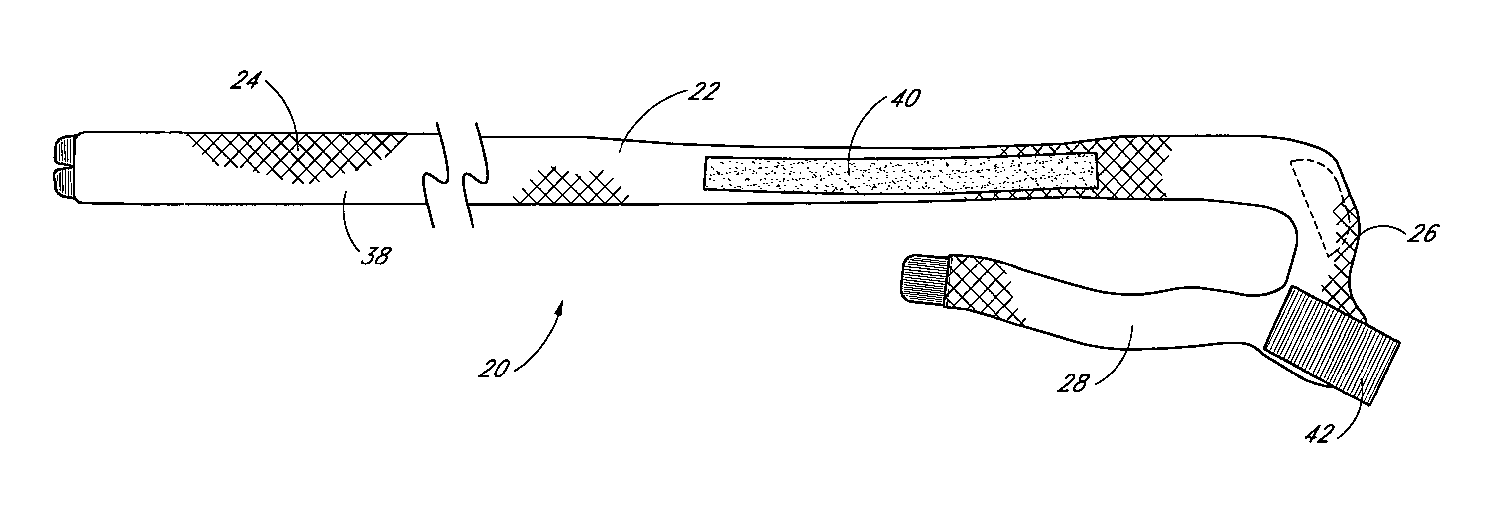 Device and method for externally rotating the femur