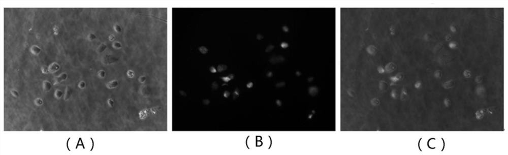 A Human Ewing Sarcoma Cell Line