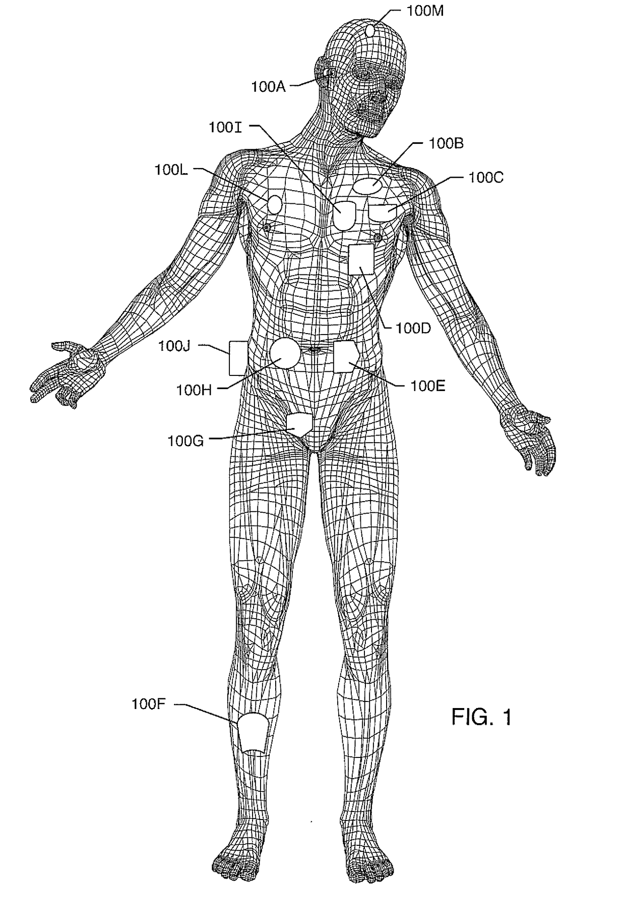 Process for manufacturing a leadless feedthrough for an active implantable medical device