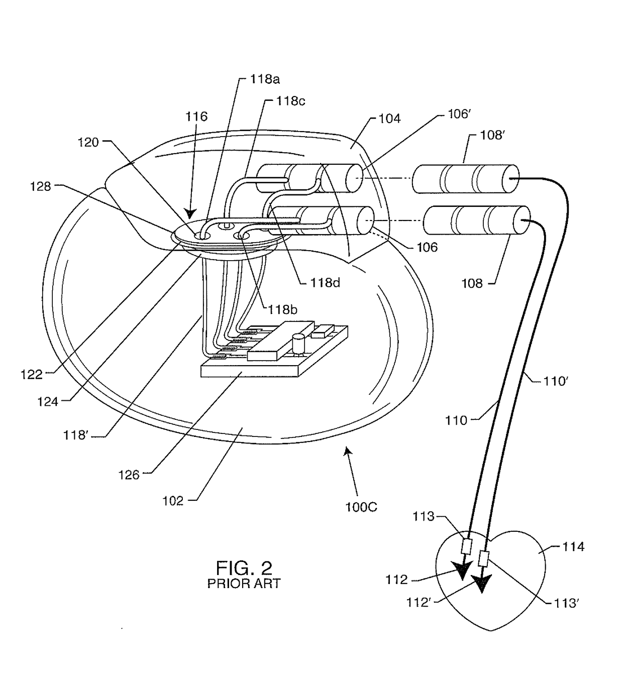 Process for manufacturing a leadless feedthrough for an active implantable medical device