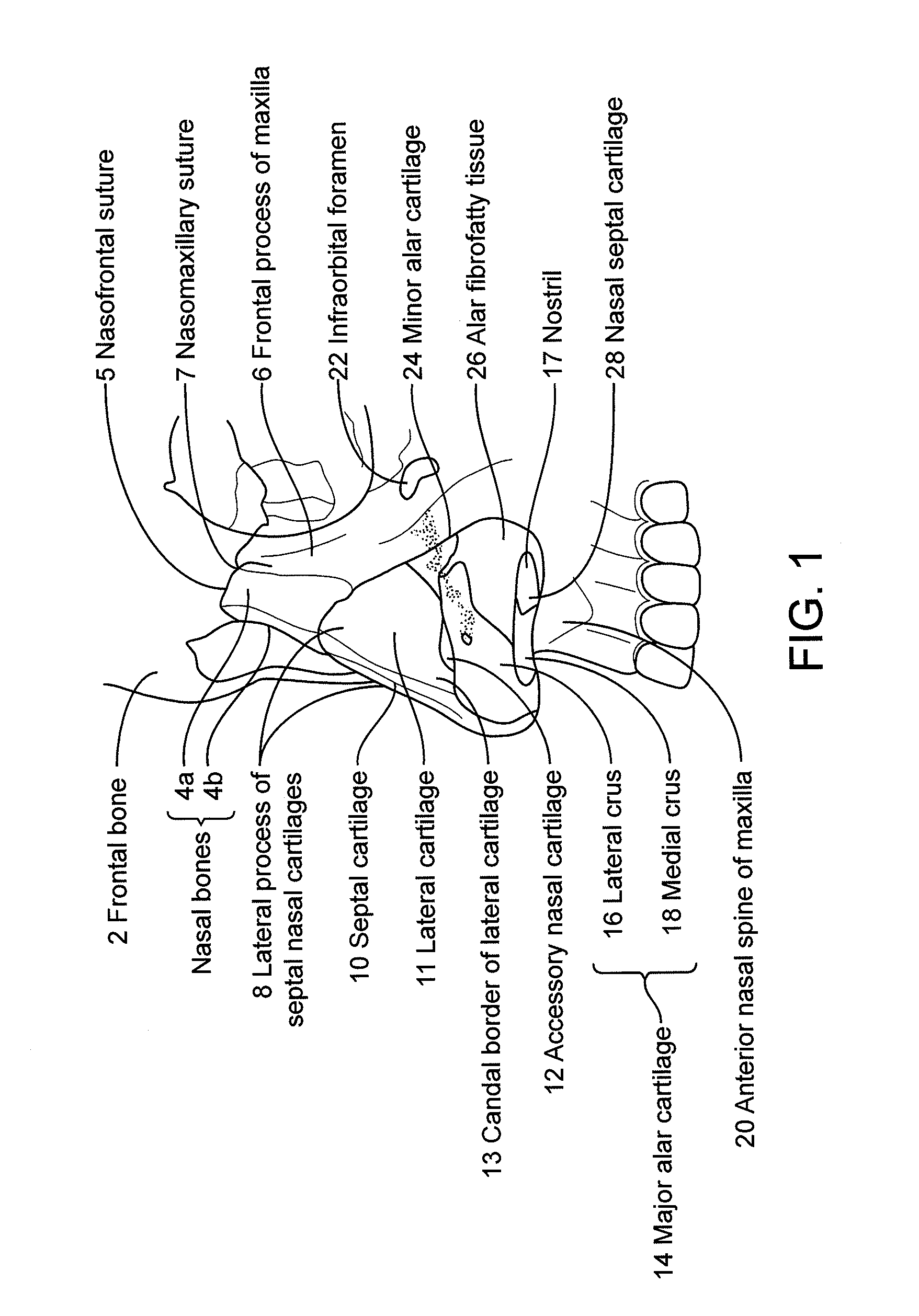 Nasal implants and systems and method of use