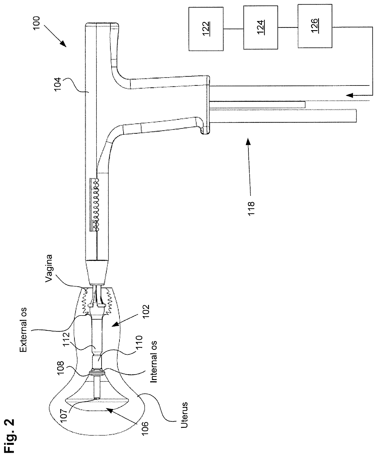 Methods and apparatus for determining the integrity of a bodily cavity