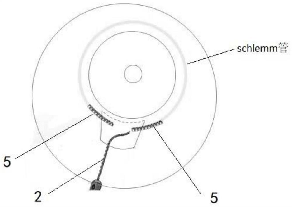 Pushing injector