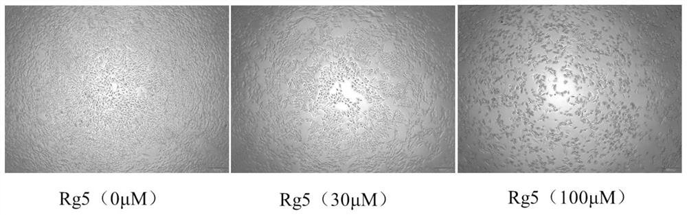 Application of ginsenoside Rg5 in resisting melanoma