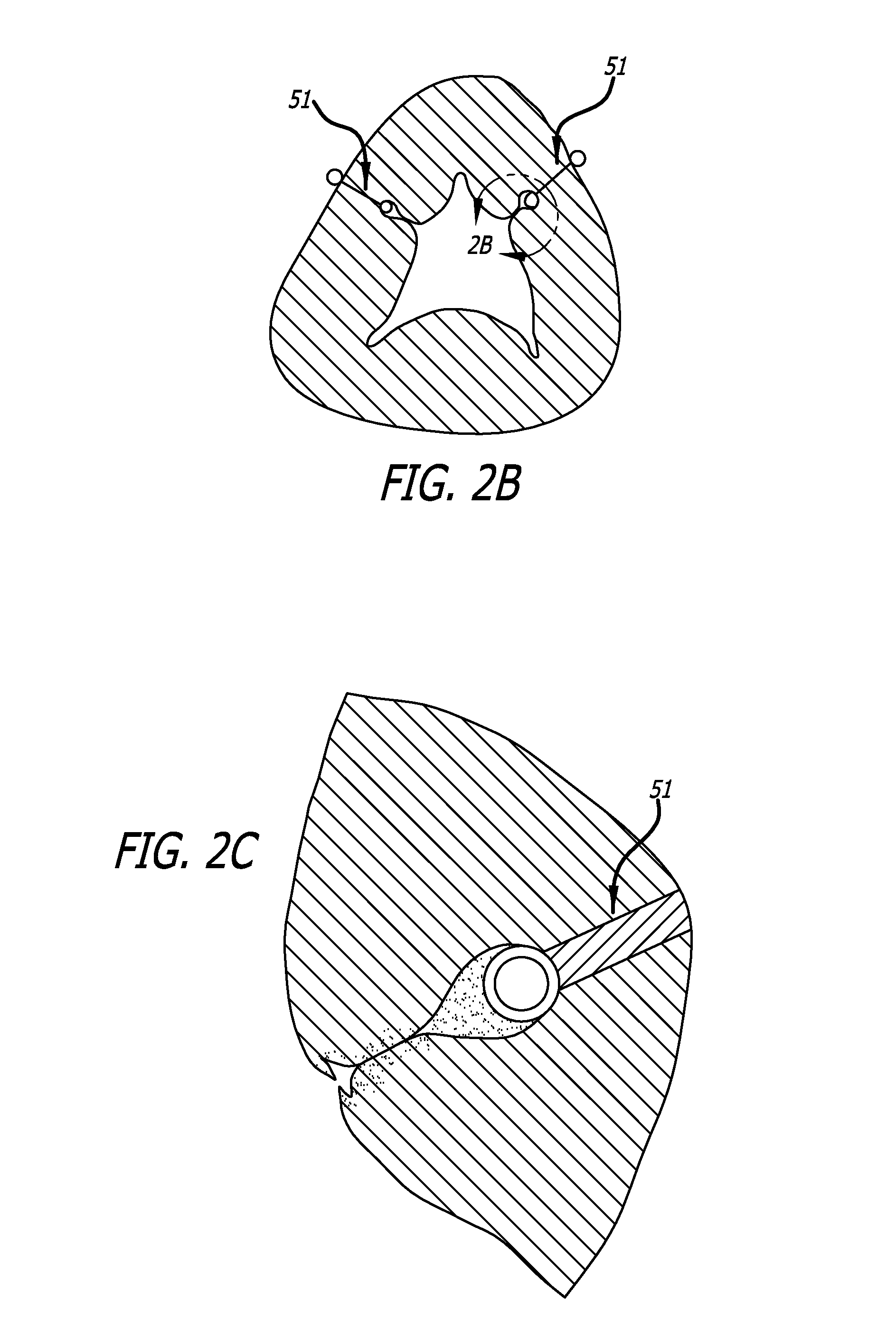 Integrated handle assembly for anchor delivery system
