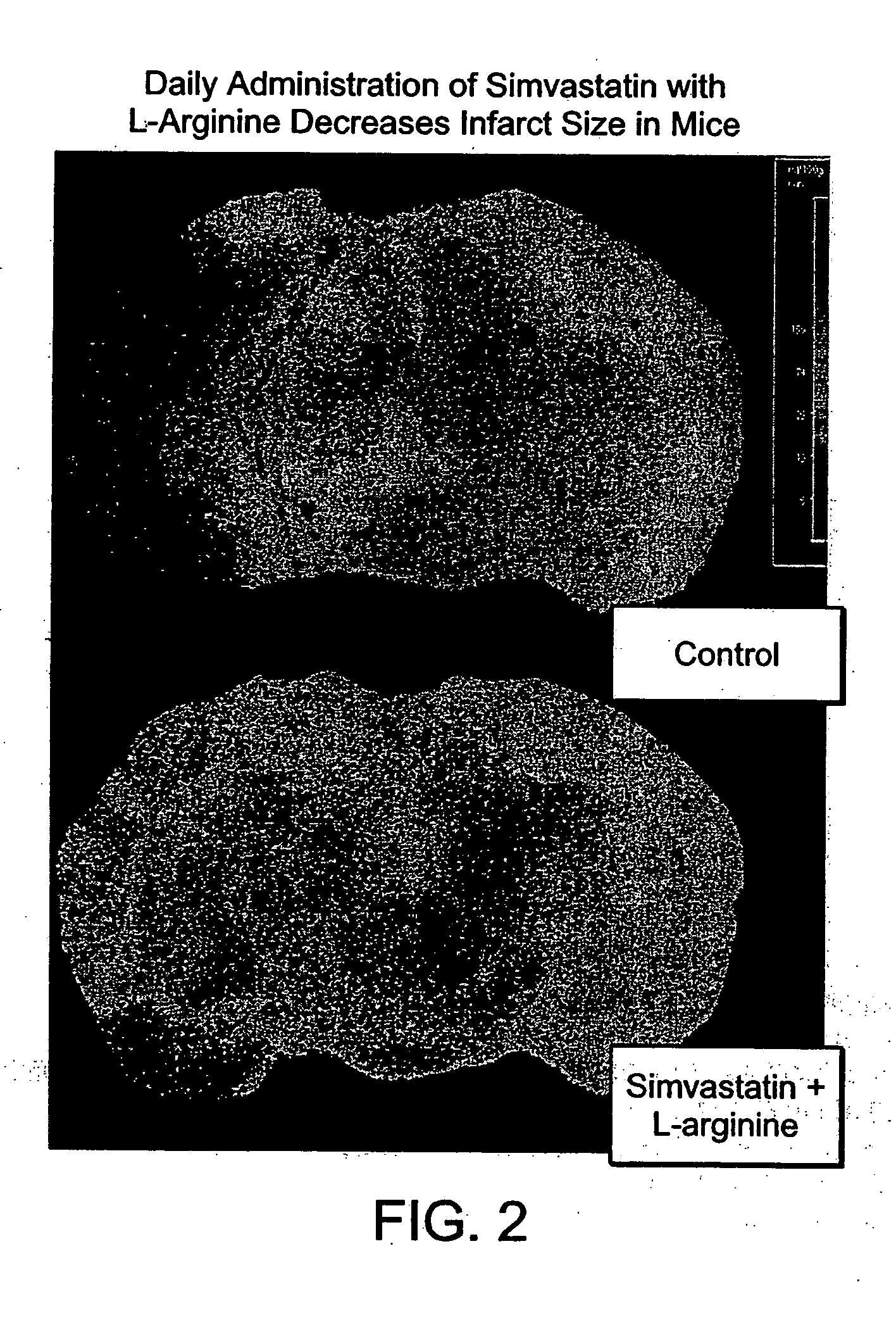 Sustained release L-arginine formulations and methods of manufacture and use