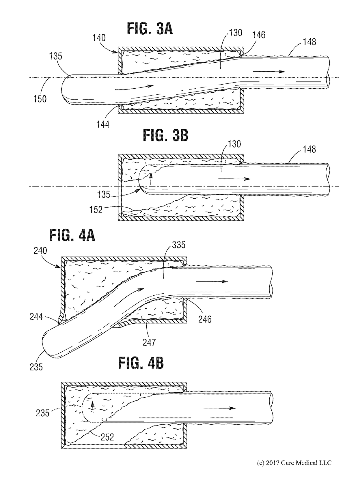 Automatic gel applying container for an intermittent urinary catheter