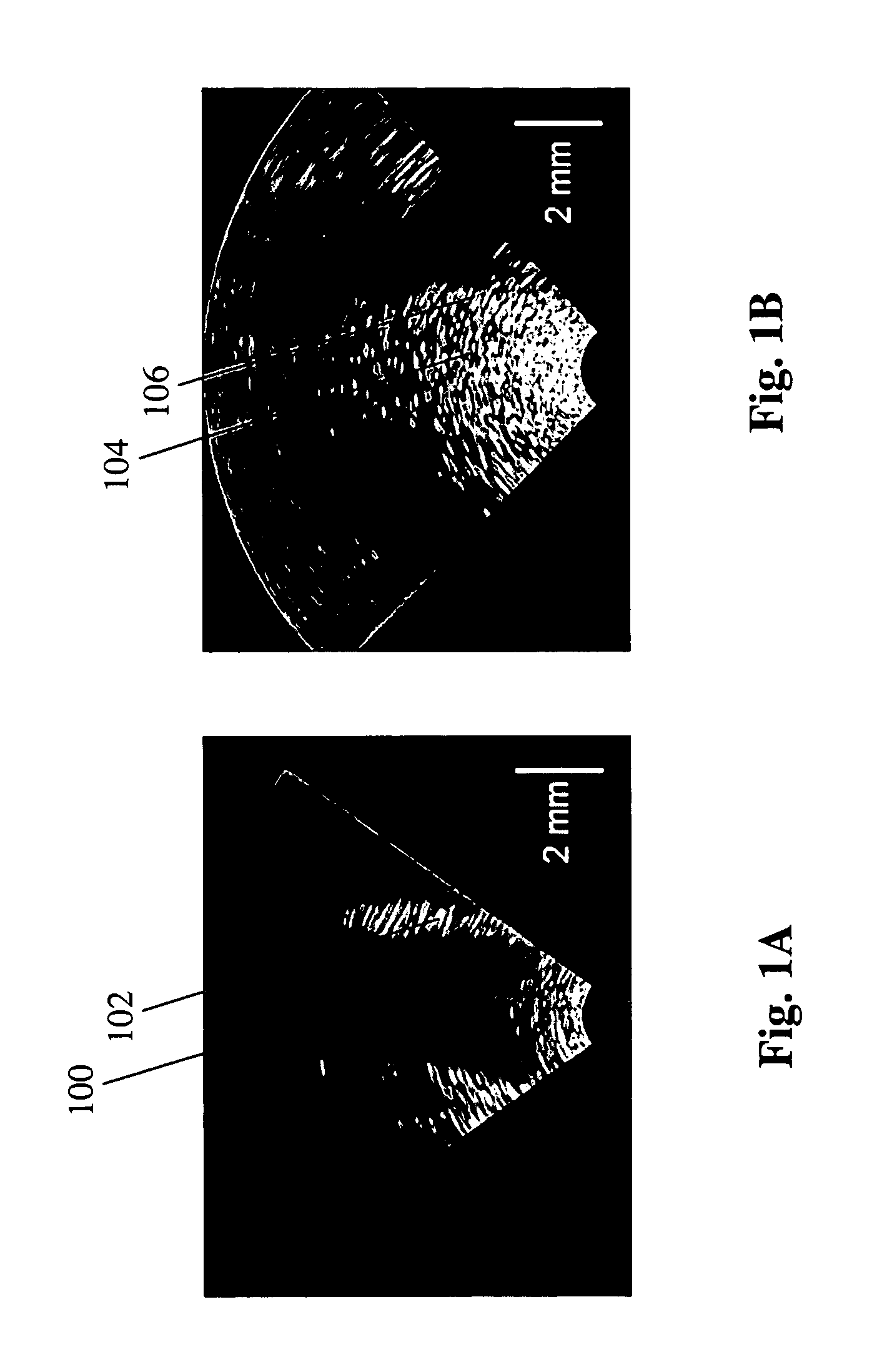 T-statistic method for suppressing artifacts in blood vessel ultrasonic imaging