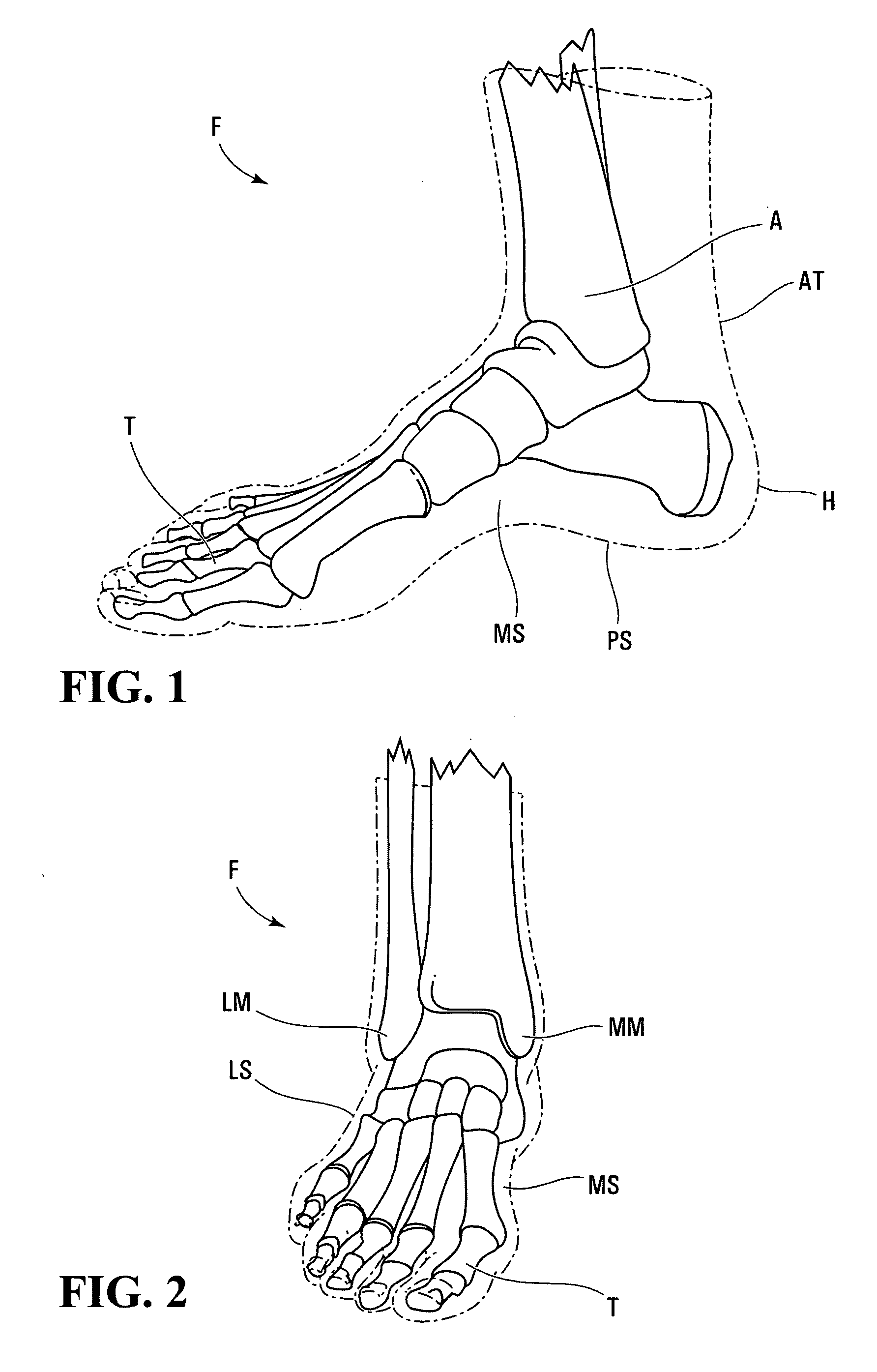 Method of manufacturing an ice skate