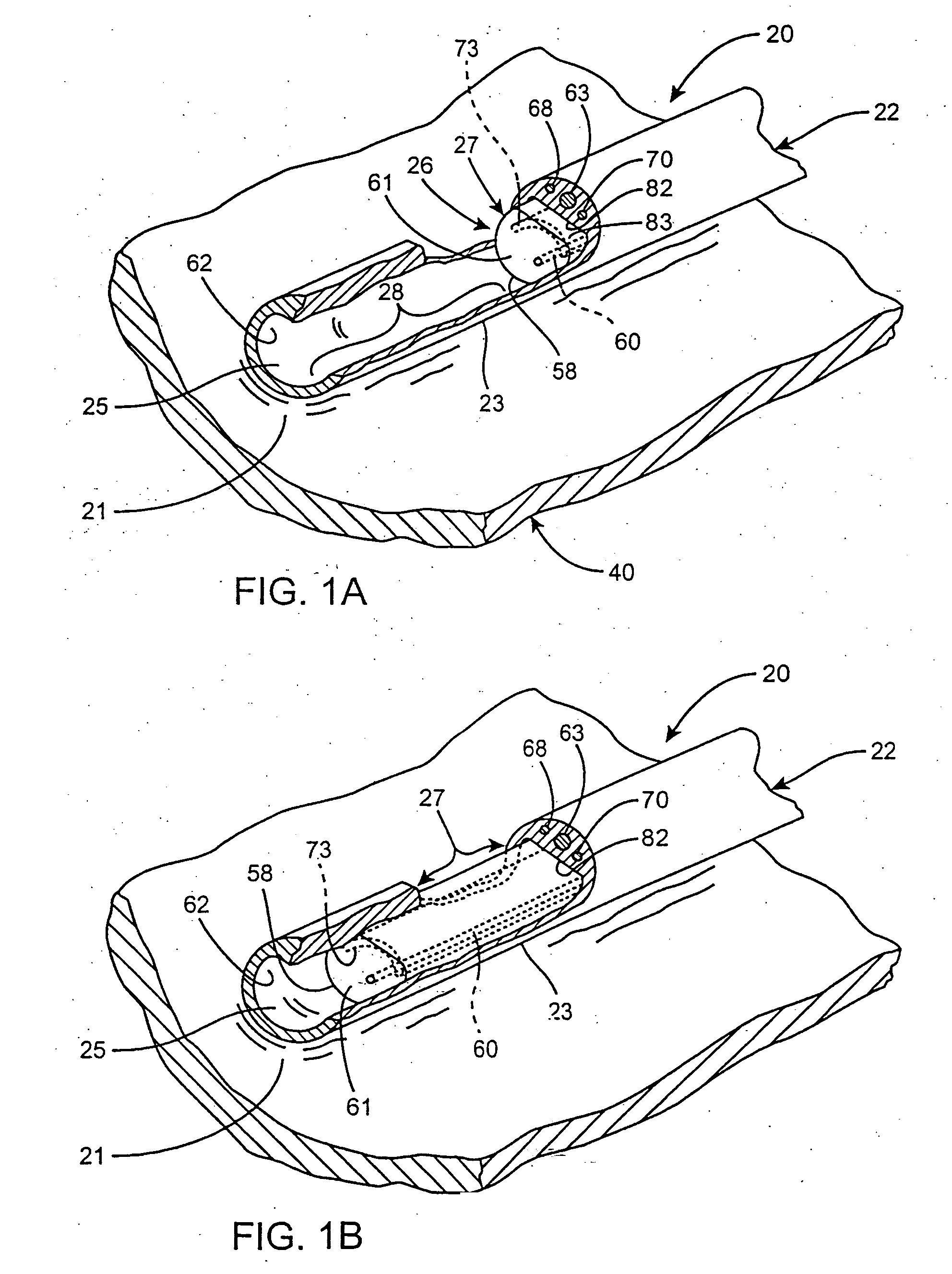 Method of positioning a medical instrument