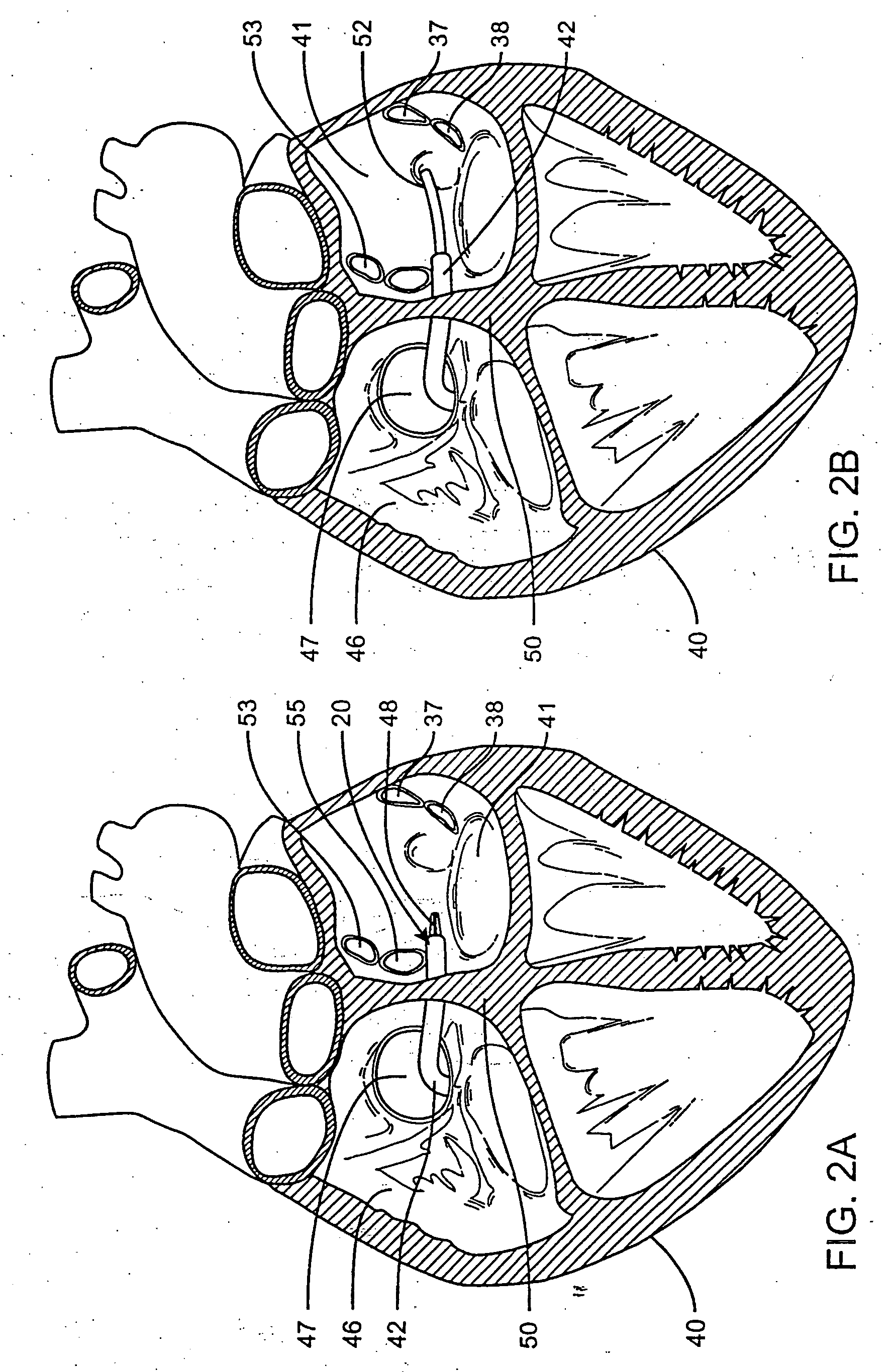 Method of positioning a medical instrument