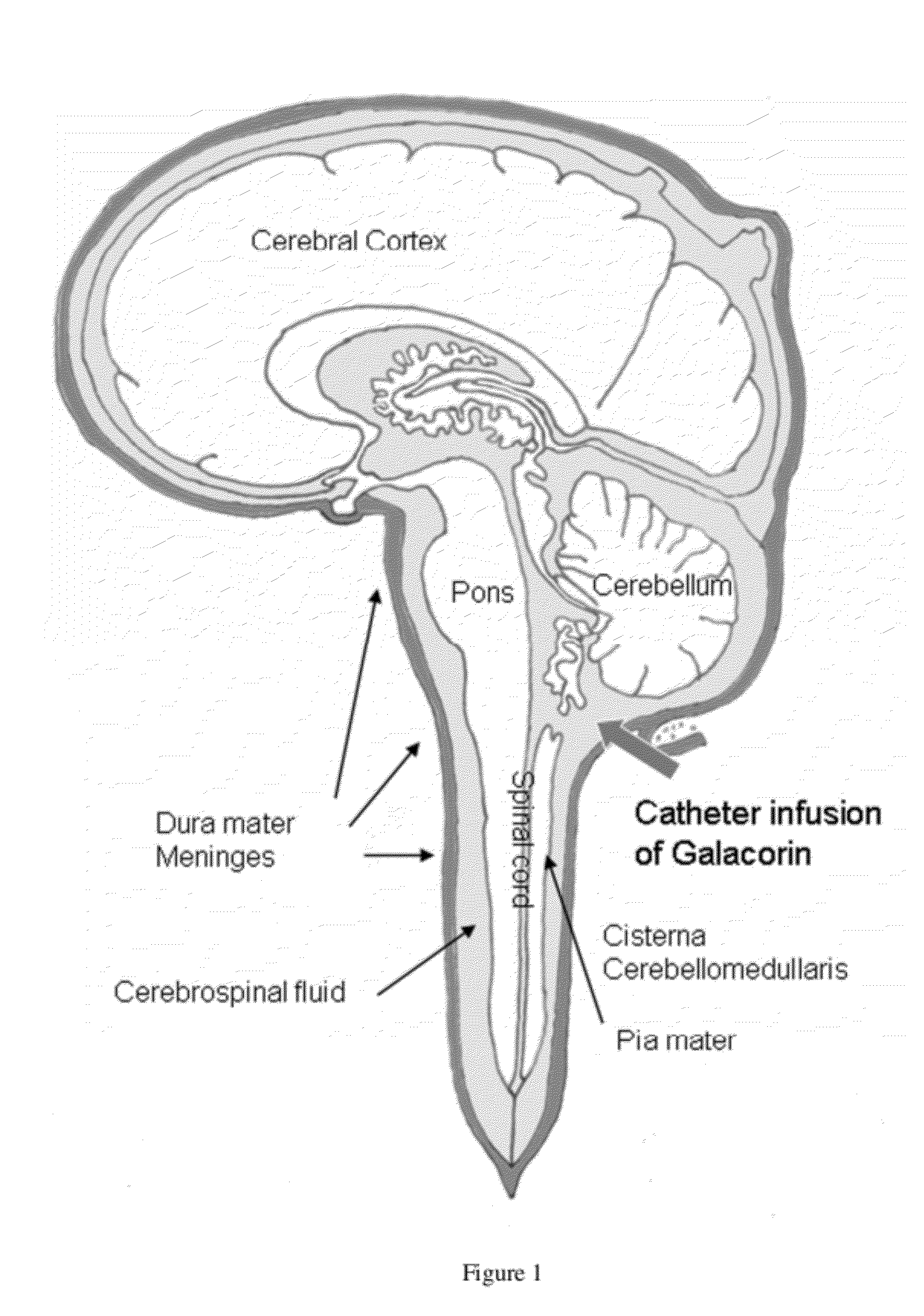 Methods for treating neurological conditions and compositions and materials therefor